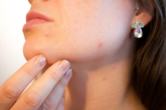 skin impacts of pollution