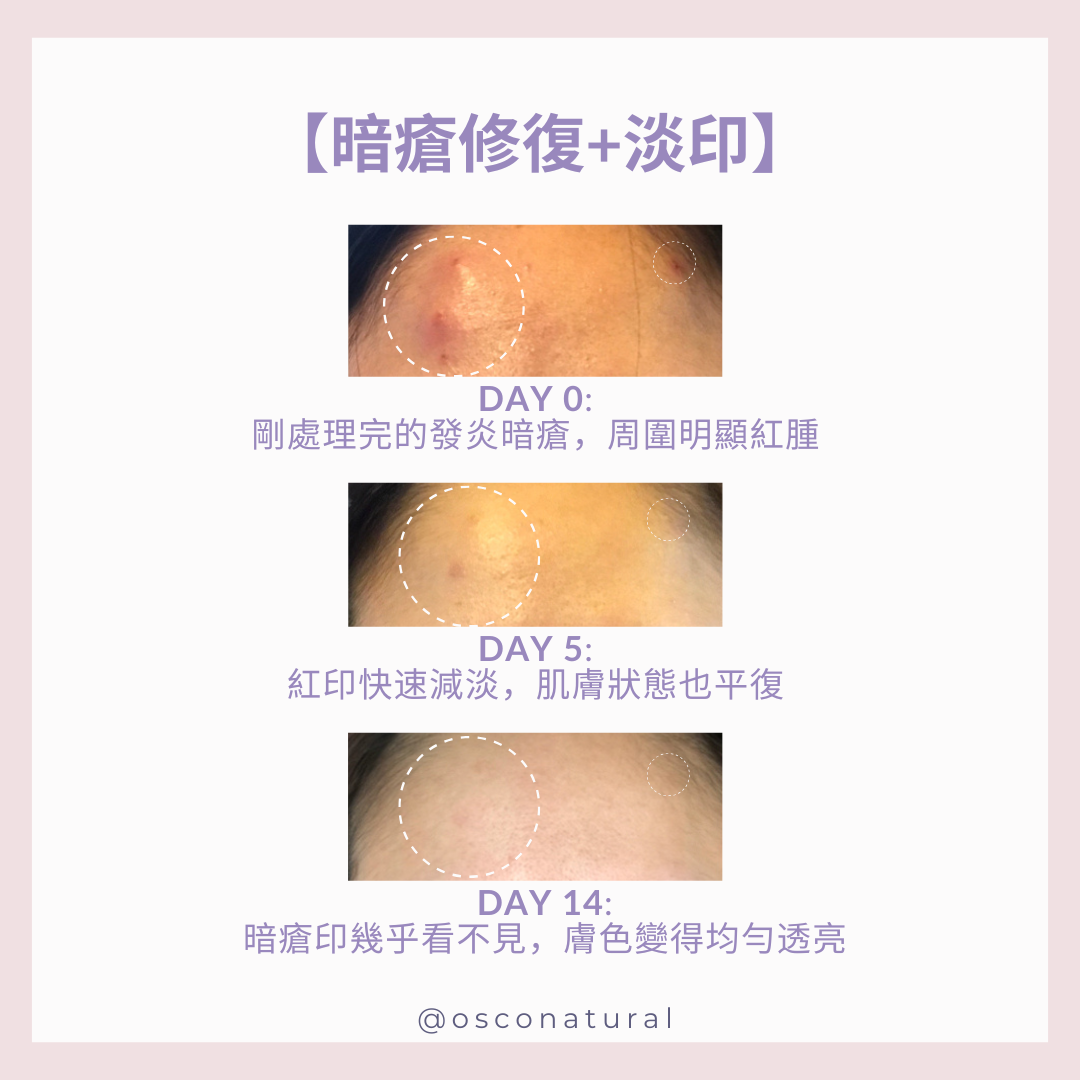 抗污染防禦精華